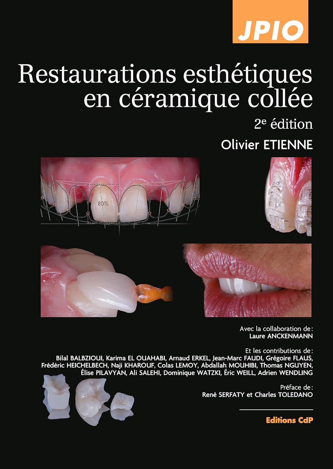 Restaurations esthétiques en céramique collée, 2e éd.1 Restaurations esthétiques en céramique collée, 2e éd. de Olivier Etienne (Auteur) Format : Relié – Image 1