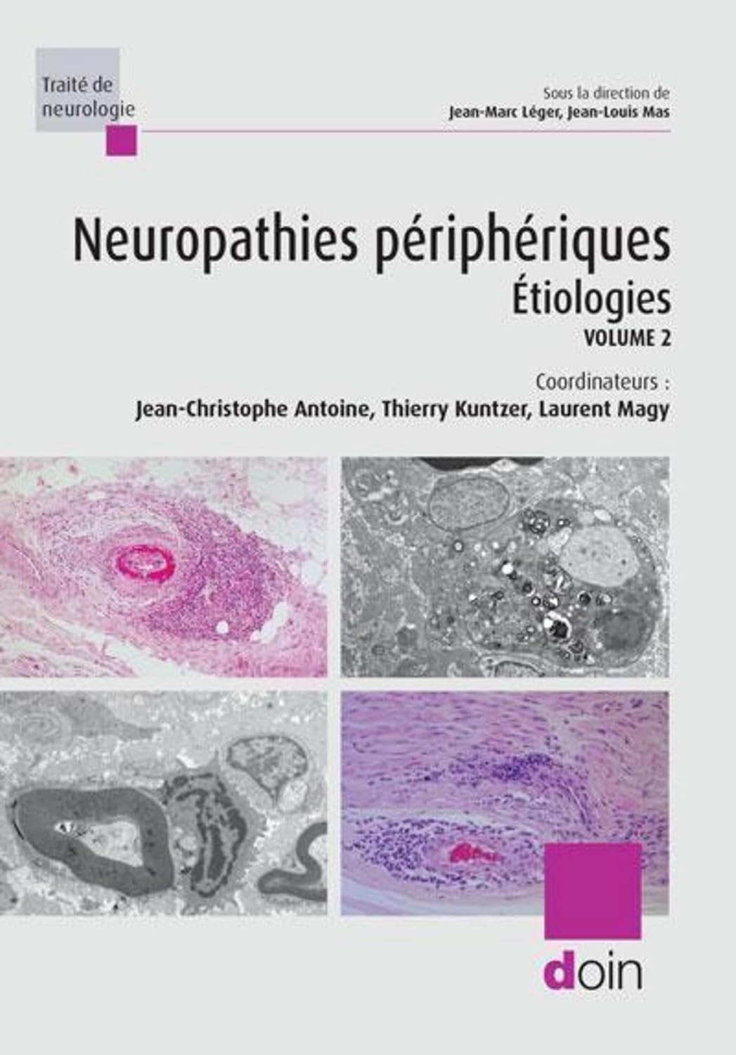 Neuropathies périphériquesV2 Neuropathies périphériques. Volume 2 : Etiologies: Volume 2 de Jean-Christophe Antoine (Auteur), Thierry Kuntzer (Auteur), Laurent Magy (Auteur) Format : Broché – Image 1